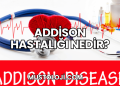 Addison Hastalığı Nedir?