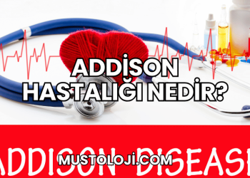 Addison Hastalığı Nedir?