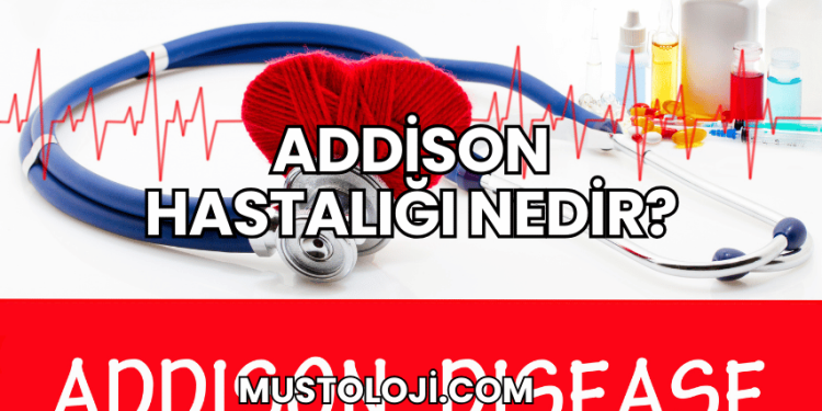 Addison Hastalığı Nedir?