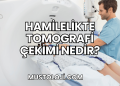 Hamilelikte Tomografi Çekimi Nedir?