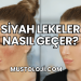 Siyah Lekeler Nasıl Geçer?