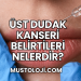 Üst Dudak Kanseri Belirtileri Nelerdir?