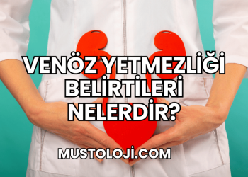 Venöz Yetmezliği Belirtileri Nelerdir?