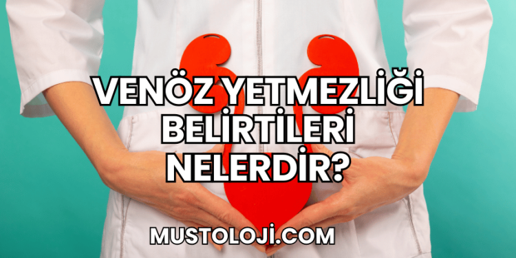 Venöz Yetmezliği Belirtileri Nelerdir?