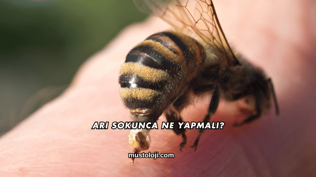 Arı Sokunca Ne Yapmalı?