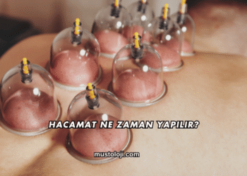 Hacamat Ne Zaman Yapılır?