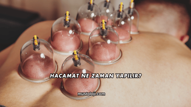 Hacamat Ne Zaman Yapılır?