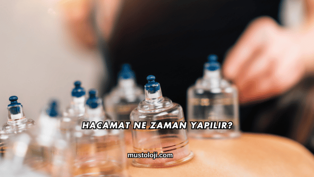 Hacamat Ne Zaman Yapılır?