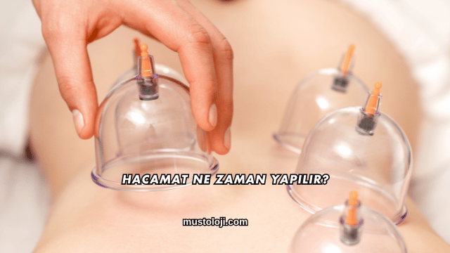 Hacamat Ne Zaman Yapılır?