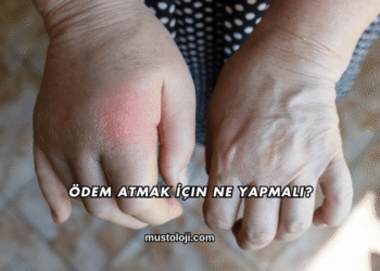 Ödem Atmak İçin Ne Yapmalı?