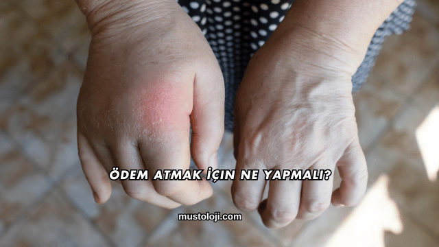 Ödem Atmak İçin Ne Yapmalı?