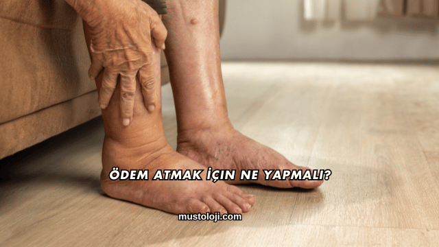 Ödem Atmak İçin Ne Yapmalı?