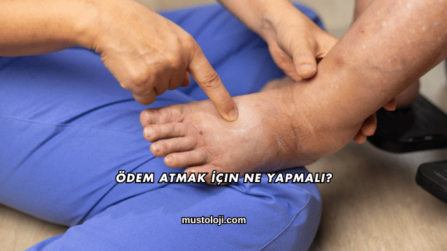 Ödem Atmak İçin Ne Yapmalı?
