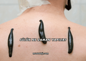 Sülük Ne Zaman Yapılır?