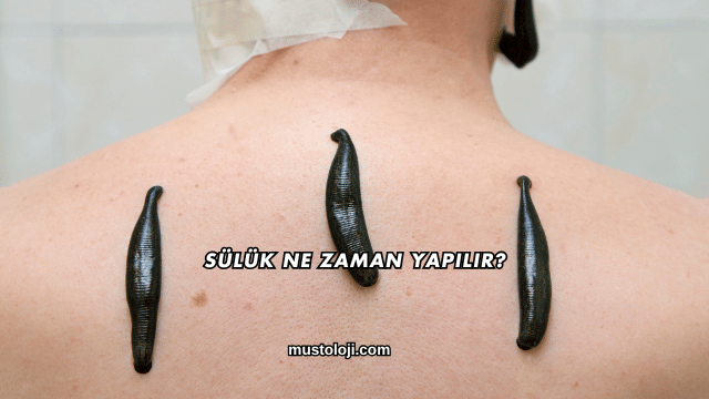 Sülük Ne Zaman Yapılır?
