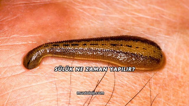 Sülük Ne Zaman Yapılır?