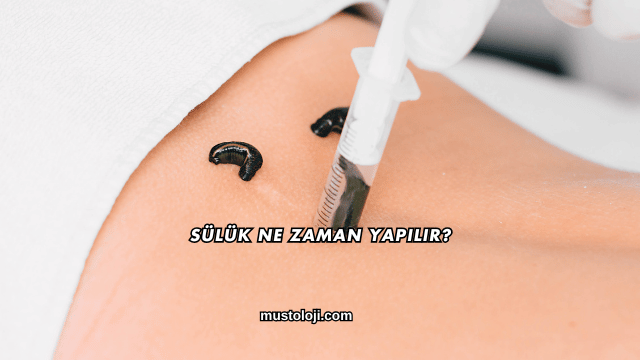 Sülük Ne Zaman Yapılır?