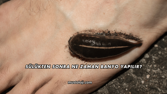 Sülükten Sonra Ne Zaman Banyo Yapılır?